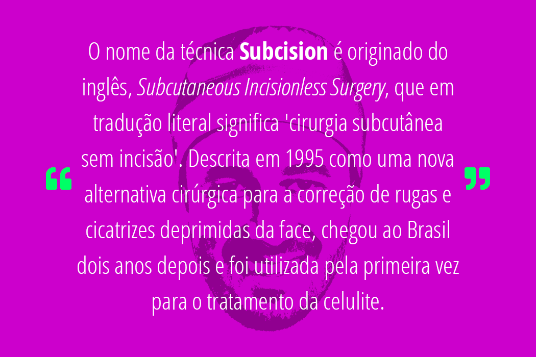Dr Frederico Fernandes - Programa Plástica e Beleza - Celulite (Subcision)