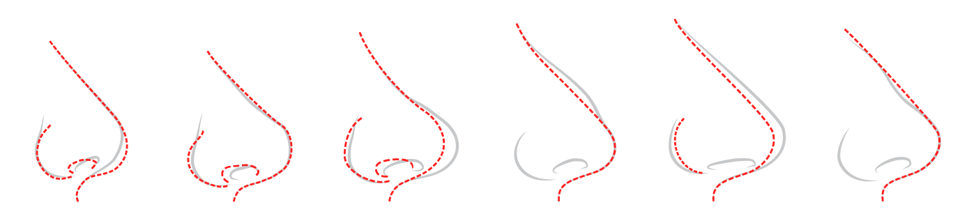 Dr Frederico Fernandes - Rinoplastia